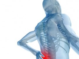 Sickness Absence Caused by Back Pain